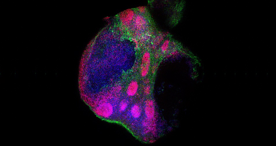 Organoide cerebral humano generado en el Laboratorio de Regeneración Neural de la Unidad Funcional de Investigación en Enfermedades Crónicas (UFIEC) del ISCIII. ISCIII.