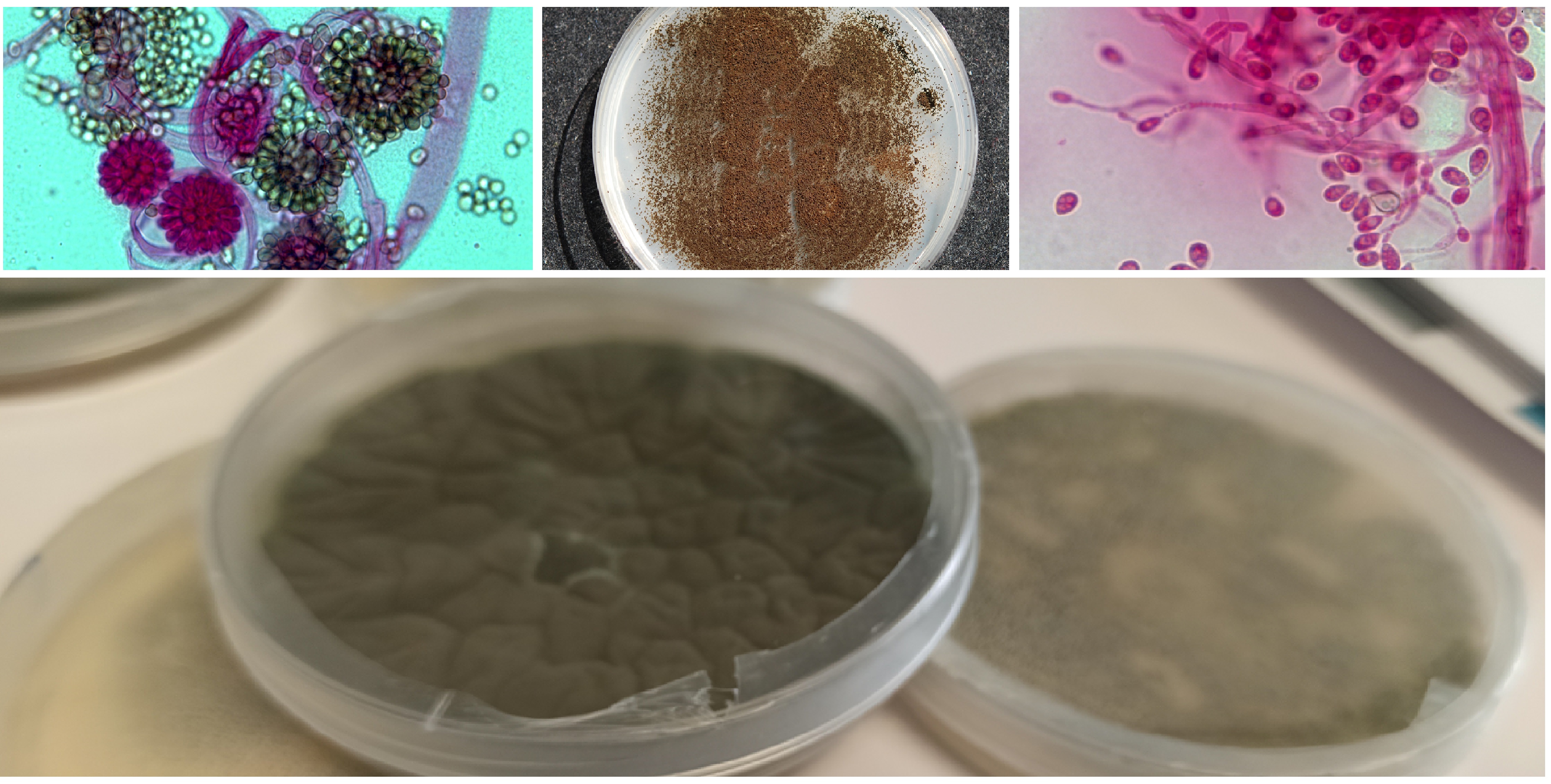 Composición con diferentes hongos. Arriba, Syncephalastrum spp, placa de Aspergillus Niger y Scedosporium. Abajo, placa de aspergillus Nidulans. 