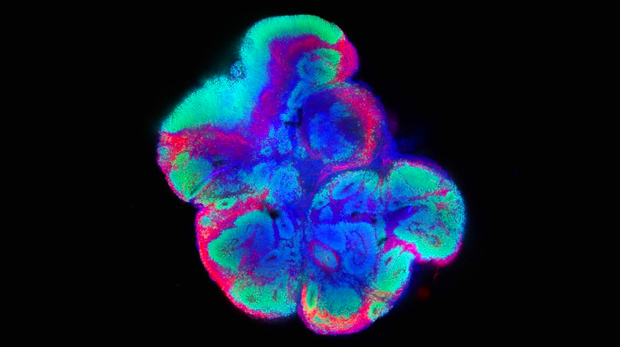 Imagen al microscopio de un organoide cerebral (Diana Sanchez Ponce, IIER-ISCIII).